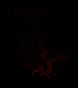 13PCW human midbrain